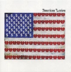 American Lesion - American Lesion