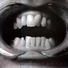 Deposito Dental - Depósito Dental (1986)