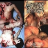 Torsofuck - Disgusting Gore And Pathology / Polymorphisms To Severe Sepsis In Trauma (2003)